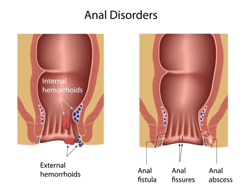 Anal leakage in pregnancy