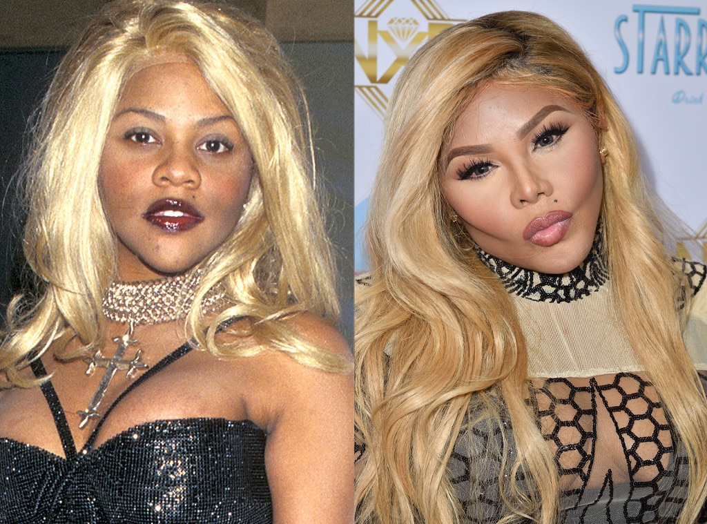Lil kim before surgery