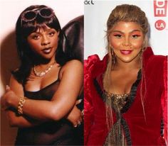 Lil kim before surgery