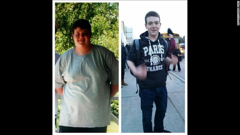 Teen weight loss stories